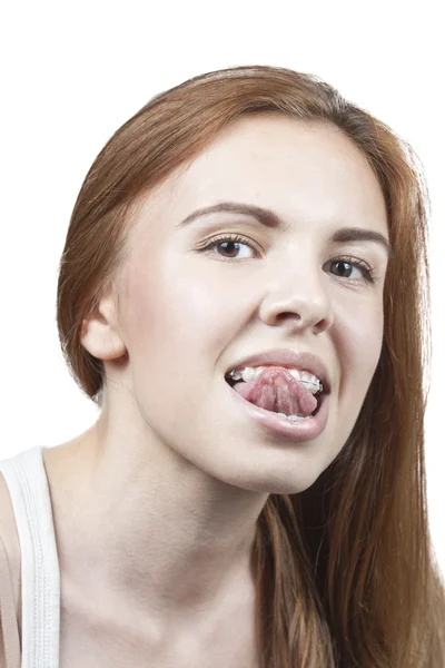 Girl with braces — Stock Photo, Image