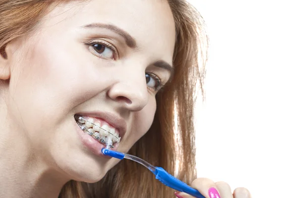 Escovar os dentes com aparelho — Fotografia de Stock