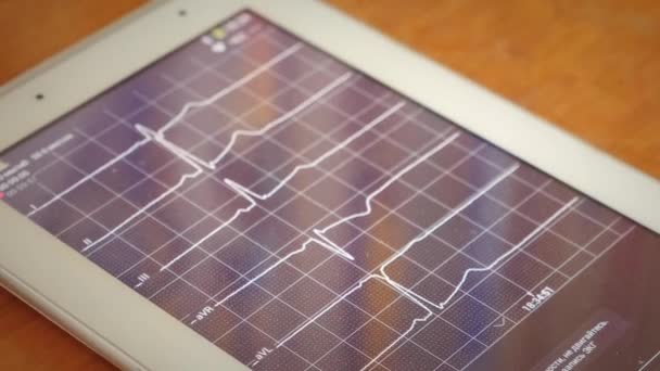 심박수 모니터. 의학적 필수 신호는 계기를 감시 한다. 화면 상의 환자의 심장 박동 — 비디오