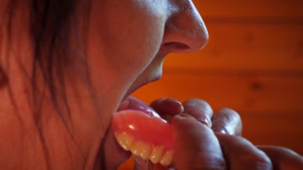 Στόμα Ηλικιωμένης Γυναίκας Ψεύτικα Δόντια Εισαγωγή Οδοντοστοιχίας Αφαιρούμενη Σιαγόνα — Αρχείο Βίντεο