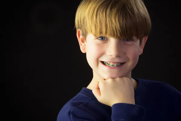 A Young Boy Shows off his Green Braces — Stock Photo, Image