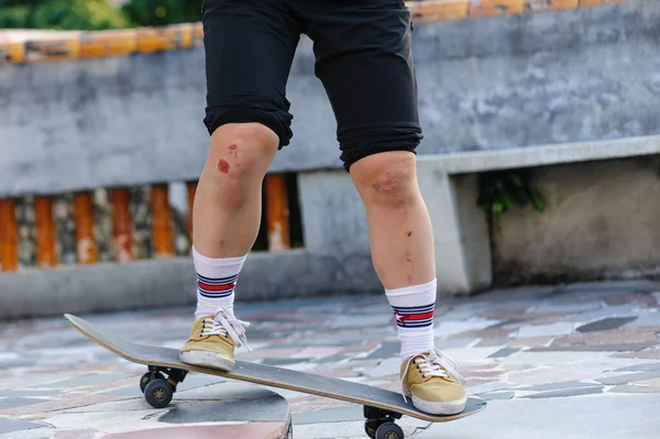 Sportovní Zranění Skateboardista Zraněnými Koleny — Stock fotografie