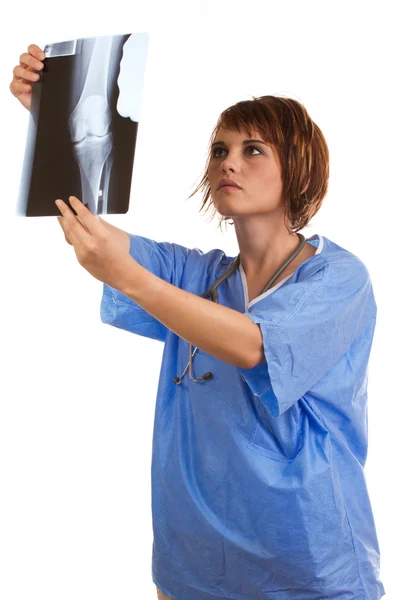 Young female doctor examining x-ray image of human knee — Stock Photo, Image