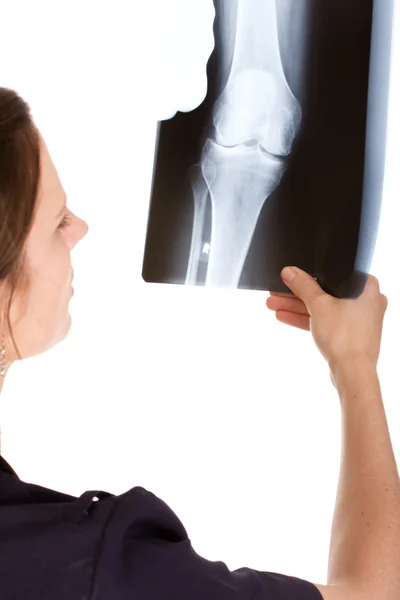 Female Caucasian doctor examining an x-ray — Stock Photo, Image