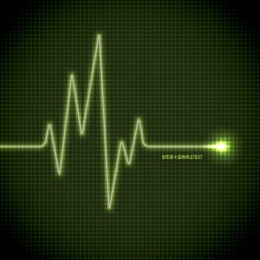 vektör Elektrokardiyogram