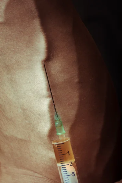 ヘロインの注射器で手します。クローズ アップ写真. — ストック写真