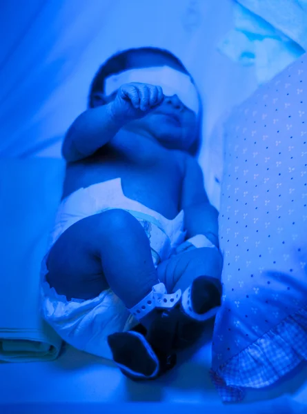 Pasgeboren baby onder blauw licht voor geelzucht behandeling — Stockfoto