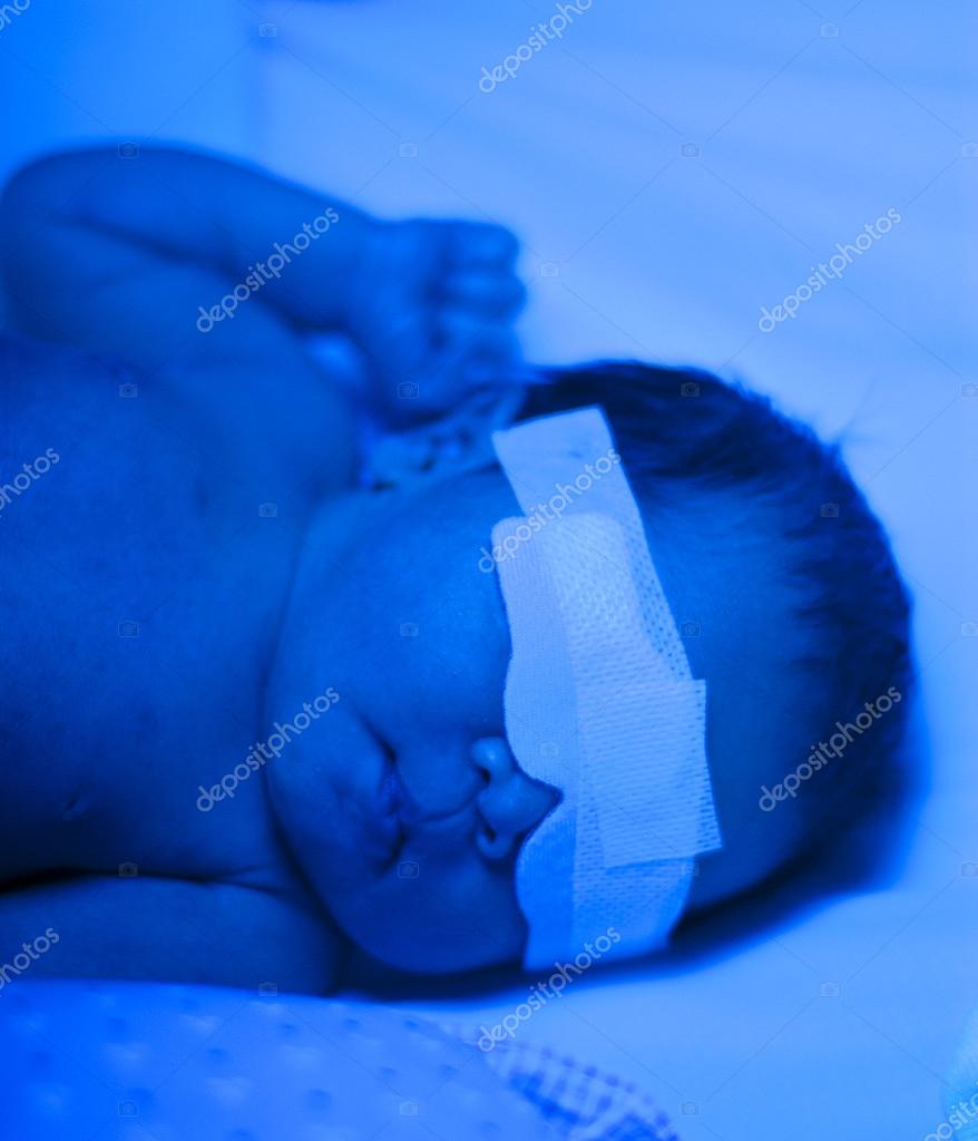 Newborn baby under blue light for jaundice treatment — Stock Photo