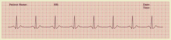 Cardiograma —  Vetores de Stock