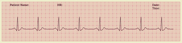 cardiogram