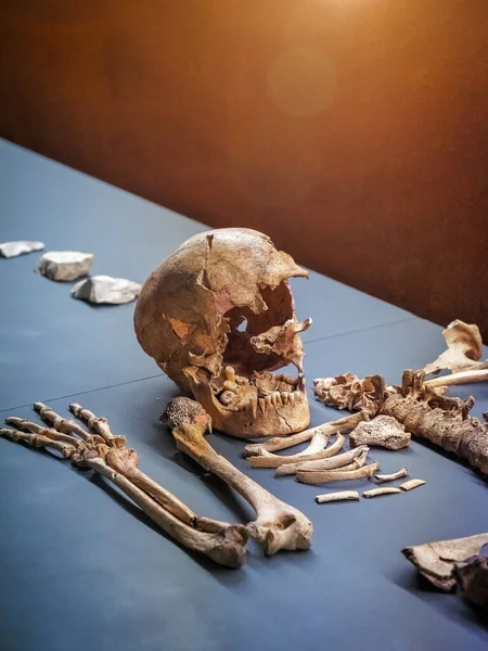 Close-up with human bones sitting on a table with blue color and brown unfocused background.