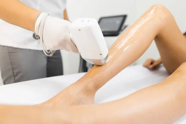 Kadın bacakları için lazer tüy çıkarma işlemi