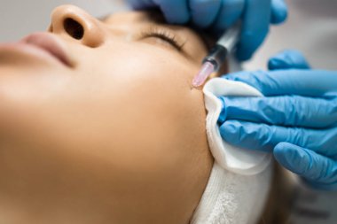 Close-up view of a beautician hands injecting hyaluronic acid into a patient's cheek
