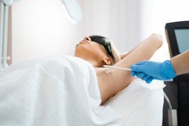 Applying hair removal gel under the arms. Woman at a laser epilation session with a modern laser in a beauty studio