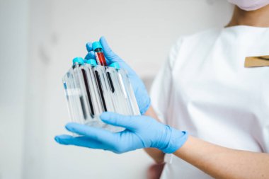 Beautician holds a container with test tubes for the plasmolifting procedure in his hands. Doctor holding test tubes with blood