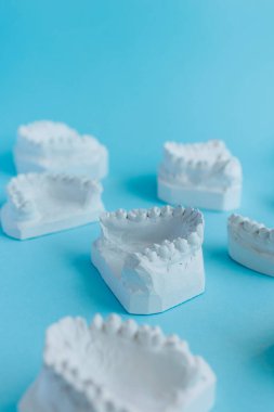 Dental casts of teeth on a blue background