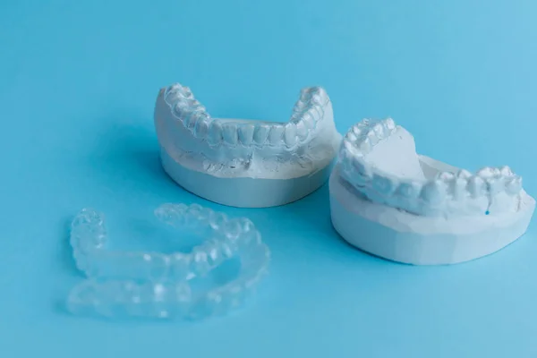 Plaster Models Human Jaws Transparent Aligner Invisible Essix Retainer Orthodontic — Foto de Stock