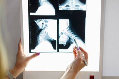 Close up view of doctor hand with pen pointing at x-ray image of neck
