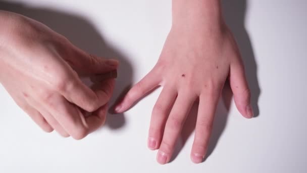 Concept simple de premiers soins. Les mains scellent la plaie avec un plâtre médical. Petite blessure à la main recouverte de plâtre médical. Vidéo de résolution 4k — Video