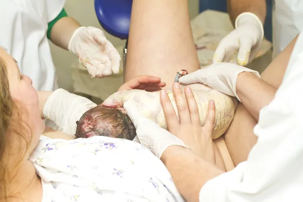 Childbirth — Stock Photo, Image