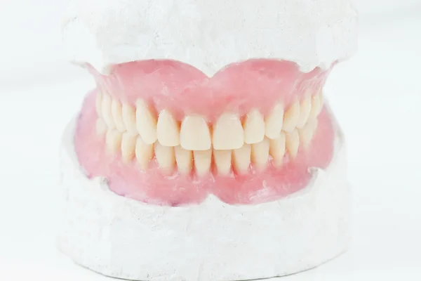 Общий протез зубов — стоковое фото