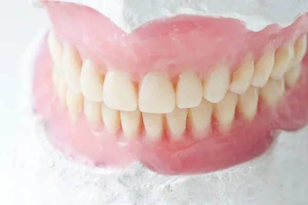 Prótese dentária total — Fotografia de Stock