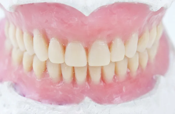 Prótese dentária total — Fotografia de Stock