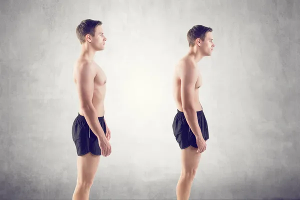 Man with impaired posture position defect scoliosis and ideal bearing — Stock Photo, Image
