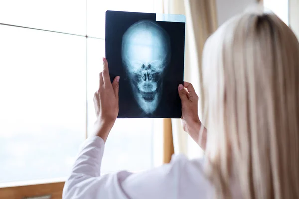 여자 의사가 사람의 두개골을 엑스레이로 촬영하는 모습 — 스톡 사진