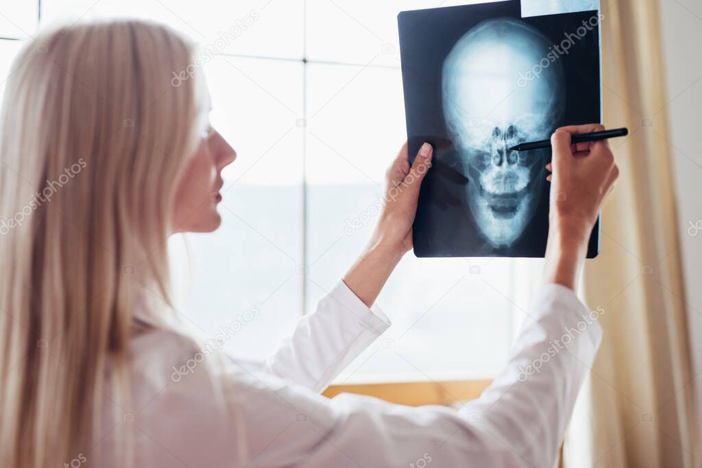 Woman doctor examines x-ray of human skull