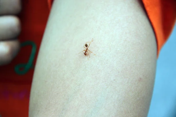 Fue mordido por una hormiga en el brazo . — Foto de Stock