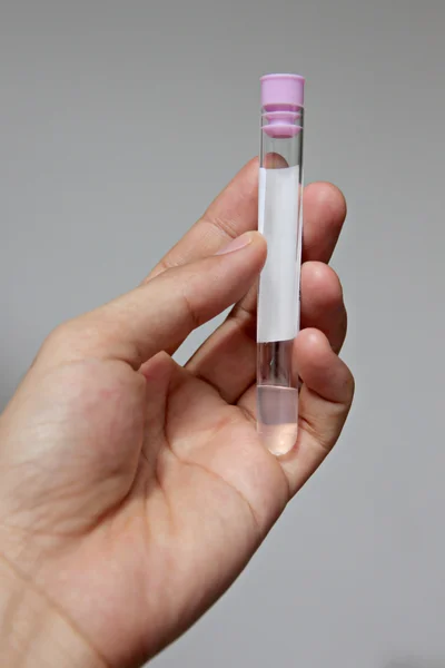 Stool test Tubes in hand. — Stock Photo, Image