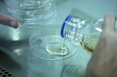 Agar sıvı test tüpleri şişeden ekleme.