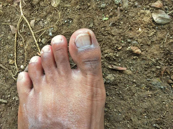 人間の足と指の近くに詳細体の部分 — ストック写真