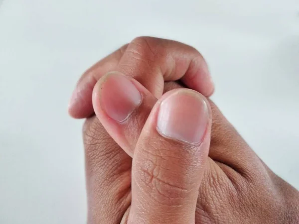 Mão Unhas Dedo Isolado Fundo Branco Closeup Polegar Saudável — Fotografia de Stock