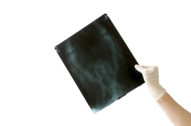 X-Ray görüntü ve doktor el