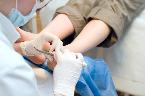 Pedicura en proceso . — Foto de Stock