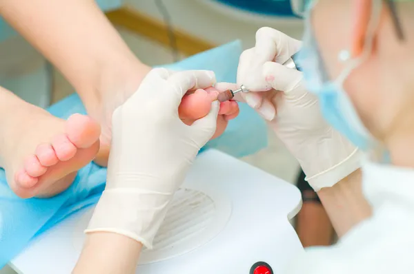 Pedicure em processo — Fotografia de Stock