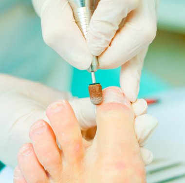 süreç içinde pedikür