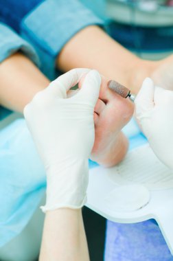 süreç içinde pedikür