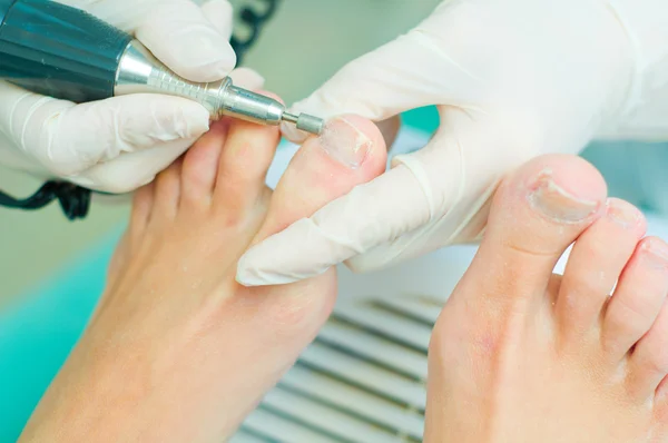 Pedicure em processo — Fotografia de Stock