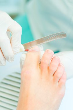 süreç içinde pedikür