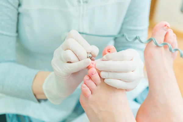 Pedicure w procesie — Zdjęcie stockowe