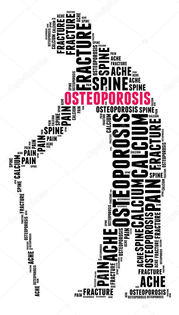 Osteoporosis in word collage 