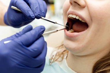 the dentist examines the teeth of the patient.close-up of dental treatment. girl at the doctor's appointment in a dental clinic. caries dental treatment