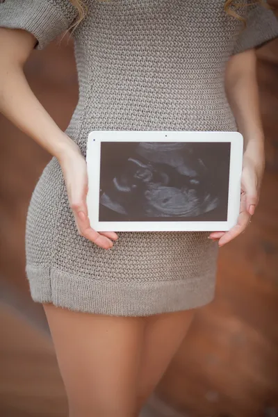 Pregnant woman holding ultrasound scan on her tummy — Stock Photo, Image