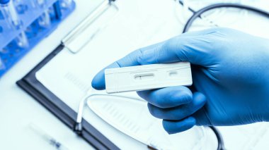 Sarlar antijen koronavirüs kitini test eder. Doktor hızlı kovid tıbbi test yapıyor. Laboratuvar hastanesinin laboratuvar geçmişi. Hasta hızlı örnek seroloji antikor numunesi