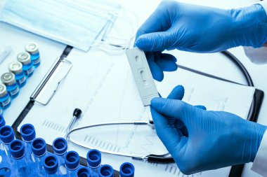 Antijen testi koronavirüs kiti. Laboratuvar hastanesinin laboratuvar geçmişi. Doktor hızlı kovid tıbbi test yapıyor. Hasta hızlı örnek seroloji antikor numunesi