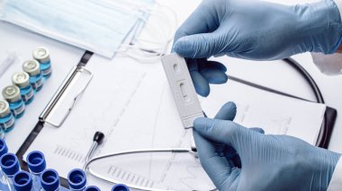 Sarlar antijen koronavirüs kitini test eder. Doktor hızlı kovid tıbbi test yapıyor. Laboratuvar hastanesinin laboratuvar geçmişi. Hasta hızlı örnek seroloji antikor numunesi