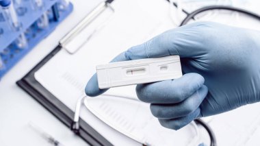 Antijen koronavirüs kiti. Doktor hızlı kovid tıbbi test yapıyor. Laboratuvar hastanesinin laboratuvar geçmişi. COVID-19 virüs testi, Coronavirüs krizi